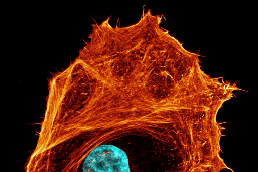 Das Zytoskelett durchzieht Zellen (gezeigt sind hier Aktinstrukturen in Orange und der Zellkern in Türkis) und gibt ihnen mechanische Stabilität. Diese Strukturen zeigen deutliche Variationen bei krebsartigen Veränderungen und beeinflussen damit maßgeblich die Zellmechanik.